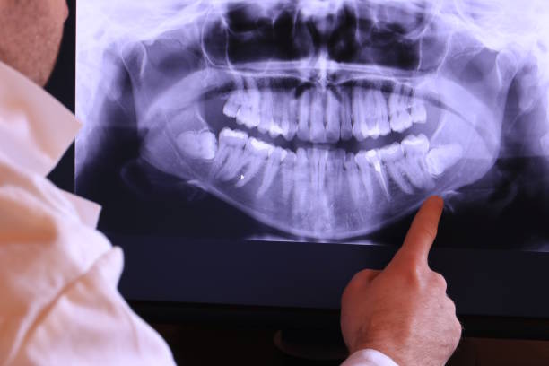 Best Emergency Treatment for Jaw Pain or Injury in Whitfield, PA